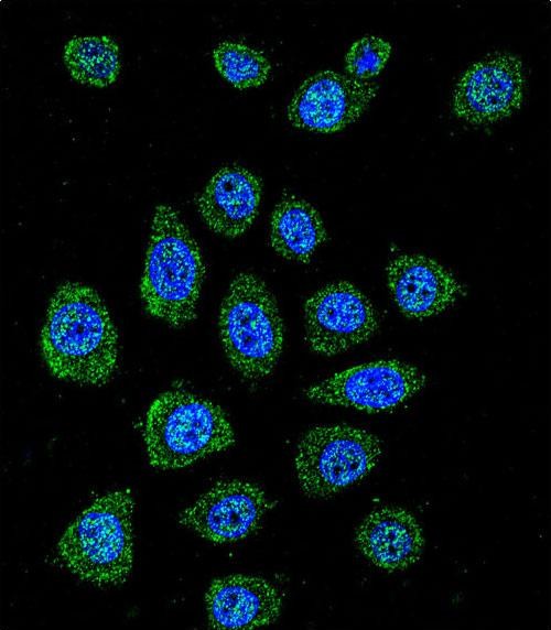 Rabbit Polyclonal Antibody to PABPN1L