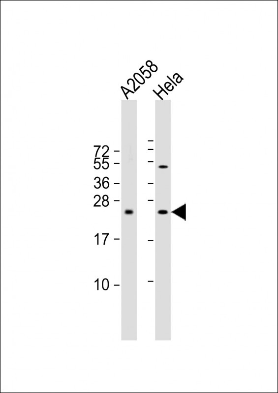 SDHD (N-term)