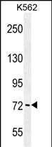 Rabbit Polyclonal Antibody to PAK6