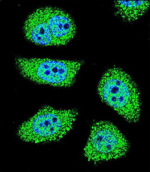 Rabbit Polyclonal Antibody to PAK6