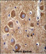 Rabbit Polyclonal Antibody to PAK6