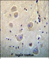 Rabbit Polyclonal Antibody to ARHB