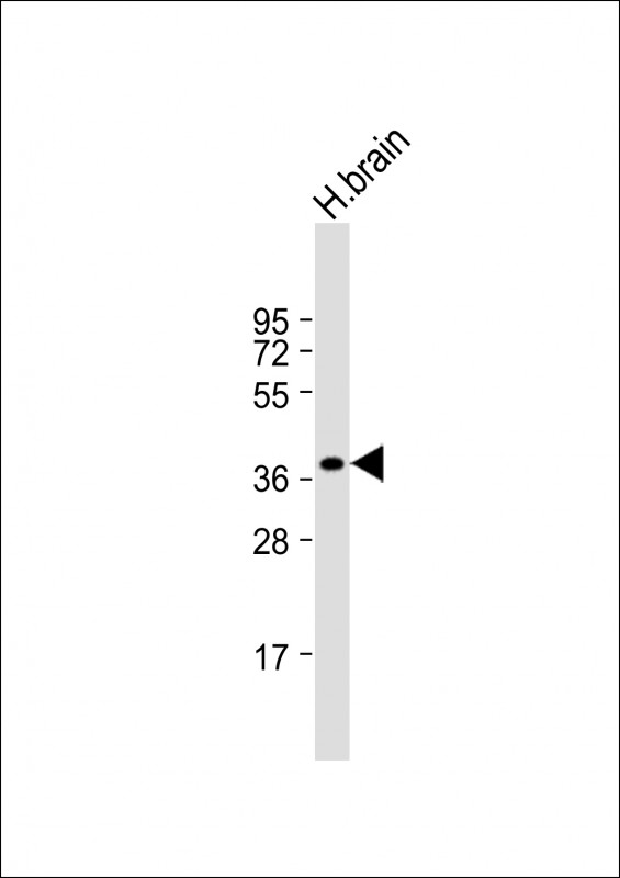 CEACAM18 (N-term)