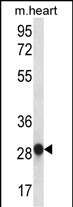 Rabbit Polyclonal Antibody to MYOGENIN (N-term)