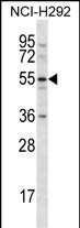 Rabbit Polyclonal Antibody to CLEC18A