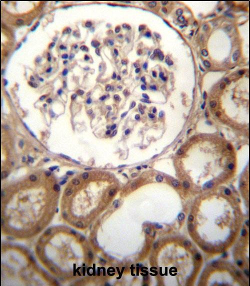 Rabbit Polyclonal Antibody to CLEC18A