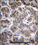 Rabbit Polyclonal Antibody to RPL15 (N-term)