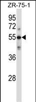 Rabbit Polyclonal Antibody to C9