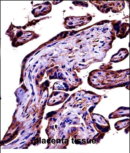 Rabbit Polyclonal Antibody to C9