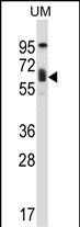 Rabbit Polyclonal Antibody to TCF3