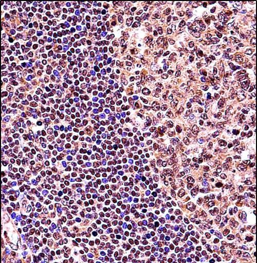 Rabbit Polyclonal Antibody to TCF3