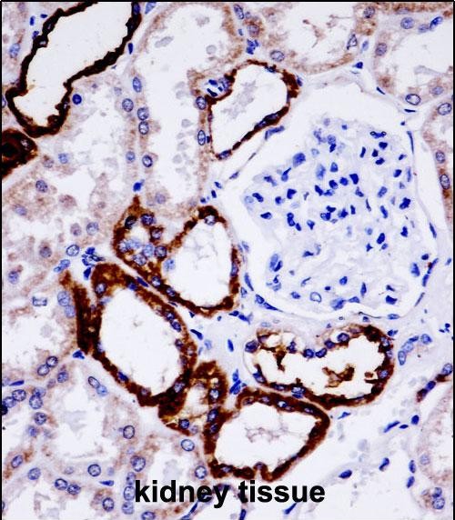 Rabbit Polyclonal Antibody to UMOD