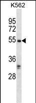 Rabbit Polyclonal Antibody to RIPK3
