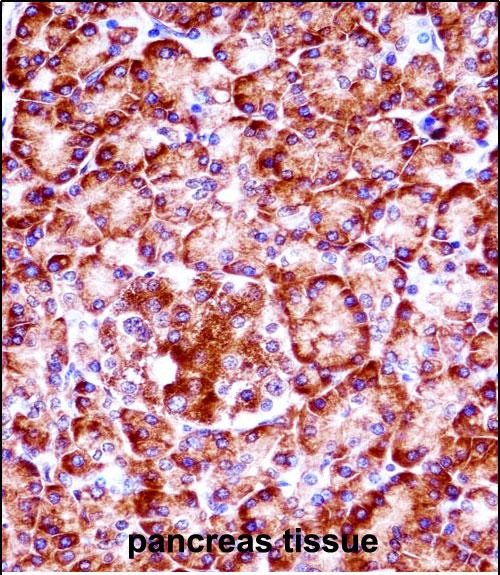 Rabbit Polyclonal Antibody to RIPK3