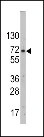 Rabbit Polyclonal Antibody to GLUT2 (SLC2A2) (N-term)