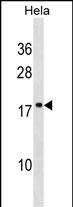 Rabbit Polyclonal Antibody to SCAND1