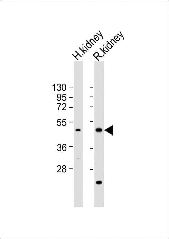 KCNK12