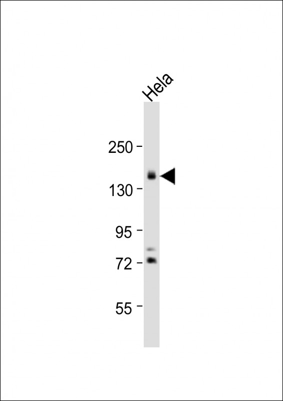 PODXL