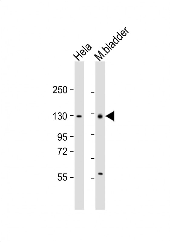 Mouse Enpp1 (N-term)