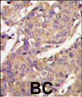 Rabbit Polyclonal Antibody to UBE2L6