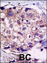 Rabbit Polyclonal Antibody to USP2 (C-term L523)