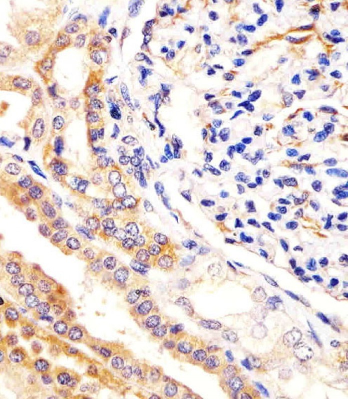 Rabbit Polyclonal Antibody to USP2 (C-term L523)