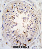 Rabbit Polyclonal Antibody to USP2 (C-term L523)