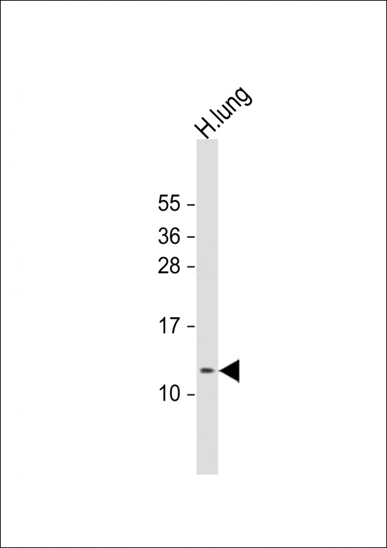 RIG