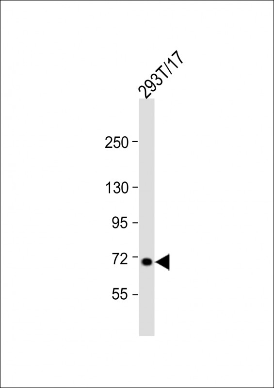 L3MBTL4
