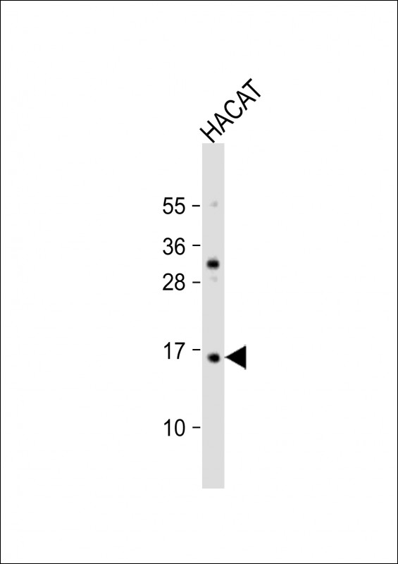 TCTA (N-Term)
