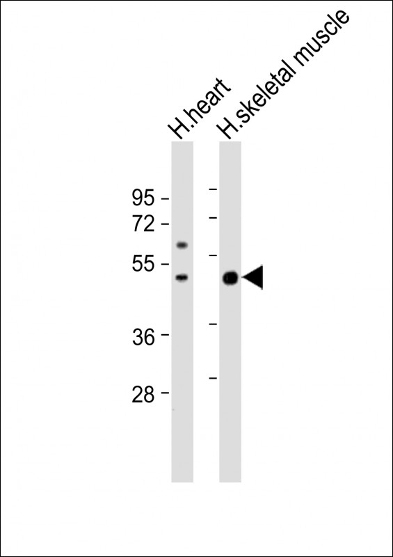 ISLR  (C-term)