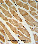 Rabbit Polyclonal Antibody to ISLR  (C-term)