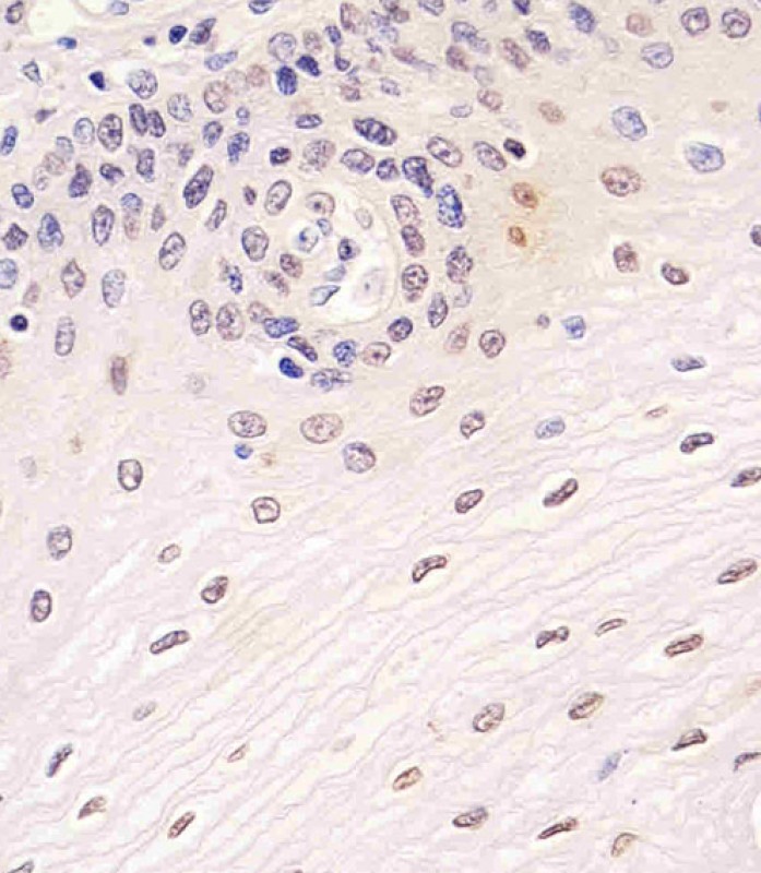 Rabbit Polyclonal Antibody to SIRT7