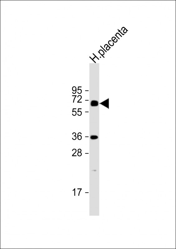 IL1R (C-term E487)