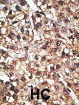 Rabbit Polyclonal Antibody to PINK1 (PARK6) (N-term T133)