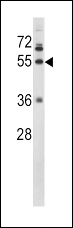 Rabbit Polyclonal Antibody to FIBG