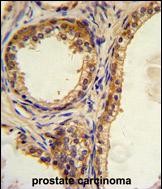 Rabbit Polyclonal Antibody to CREB3L1