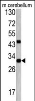 Rabbit Polyclonal Antibody to ZWINT