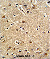 Rabbit Polyclonal Antibody to ZWINT
