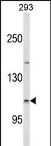 Rabbit Polyclonal Antibody to ESPN (N-term)