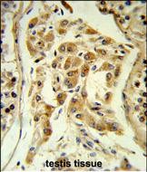 Rabbit Polyclonal Antibody to ESPN (N-term)