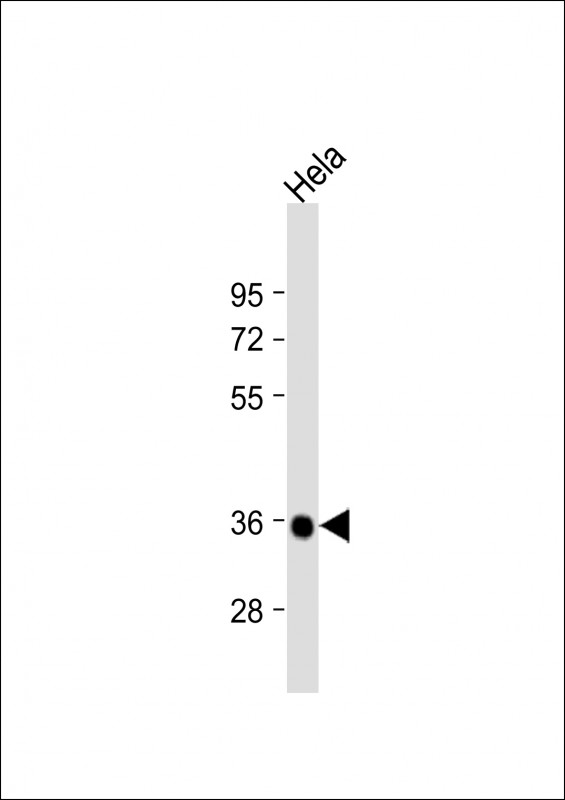 Deoxyguanosine Kinase (DGUOK)
