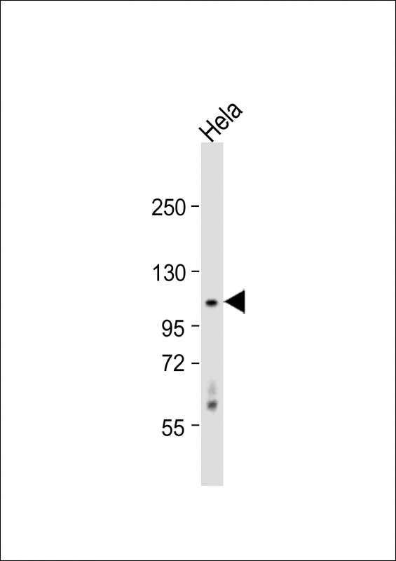 CDKL5 (STK9)