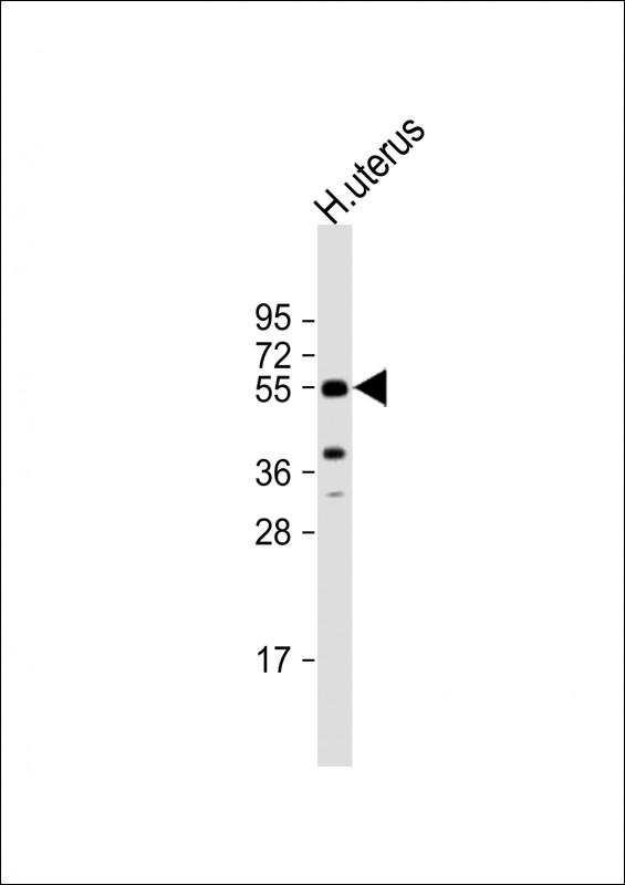 Aromatase (CYP19A1)