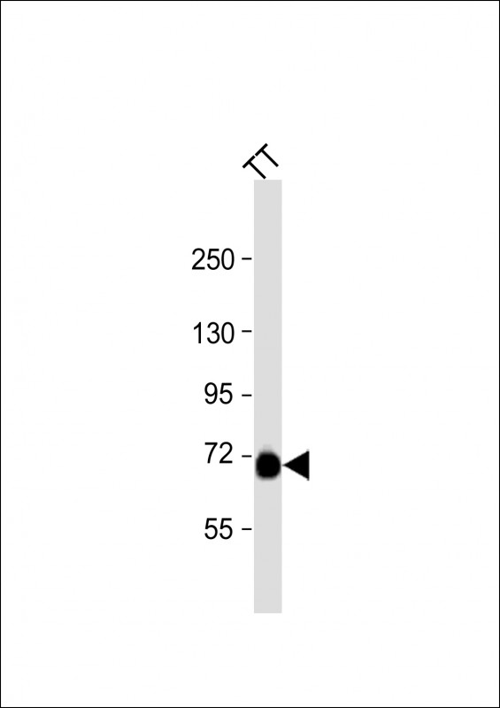PCSK2 (N-term)