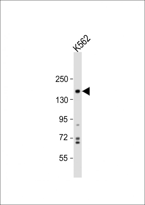 PHLPP1 (N-term)