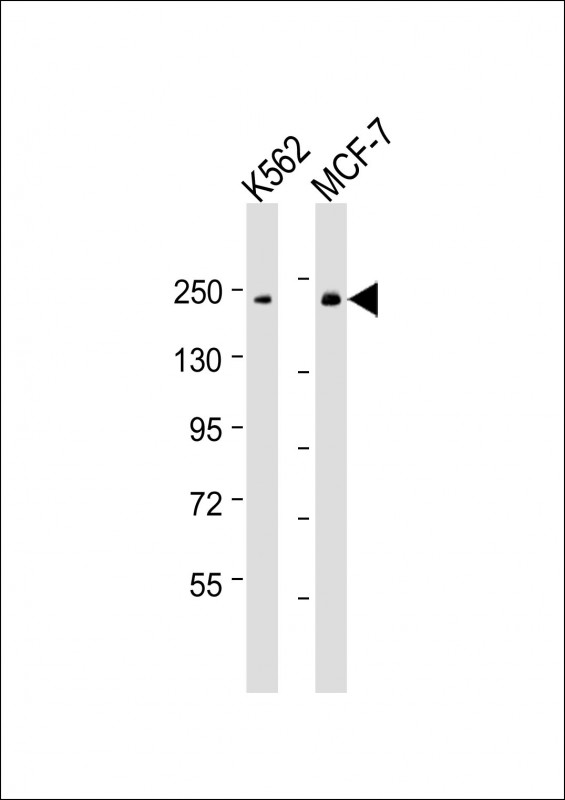 XRN1