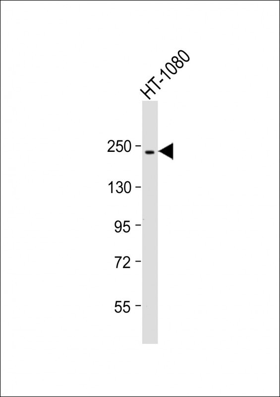 PBRM1