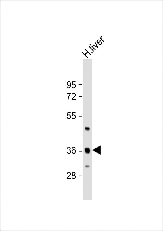 C6orf58