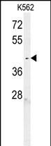Rabbit Polyclonal Antibody to C6orf58